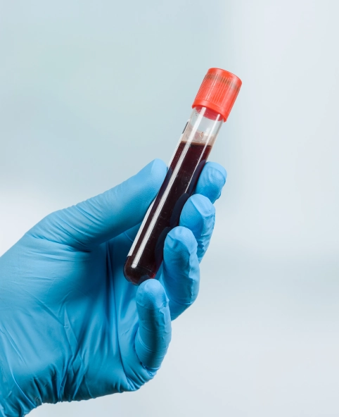 정밀 혈액 검사